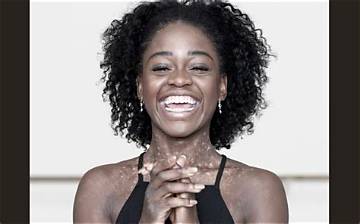 Michaela Deprince Net Worth