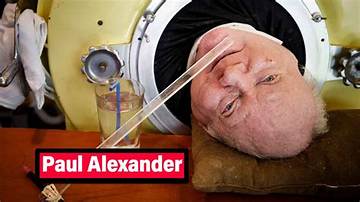Paul Alexander Net Worth